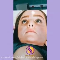 نمونه ای دیگر از عمل بینی