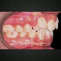 بهترین دکتر ارتودونسی تهران | دکتر داوودیان