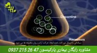 علائم بیماری پارکینسون چیست؟؟؟ بهترین راهکار درمانی بیماری پارکینسون...