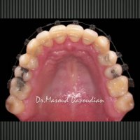 ارتودنسی تهران | دکتر داوودیان