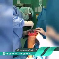 پروتز زانو چگونه کار گذاشته می شود؟ | دکتر مسعود صابری متخصص ارتوپد و جراح تعویض مفصل زانو و ران