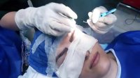 کاشت ابرو در کلینیک تخصصی آریامن