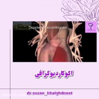 انیمیشن اکوکاردیوگرافی قلب