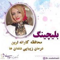 درمان زیبایی ایمن با بلیچینگ دندان