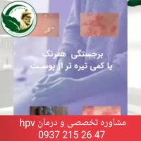 علت زگیل تناسلی چیست؟؟