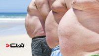 مشکل چاقی مفرط در چهار دهه، سه برابر شده است!