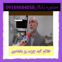 آیا کبدچرب هم درمان دارد