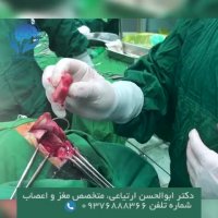 فیلم جراحی کالوزوتومی بیمار با تشنج مکرر