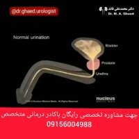 چه افرادی دچار پروستات می شوند؟