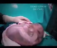 وضعیت شگفت انگیز جنین در زایمان طبیعی