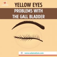 چشم درباره سلامتی چه می گوید؟