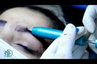 طراحی و ساخت یونیت تمام اتوماتیک کاشت مودر کلینیک زیبایی مهر