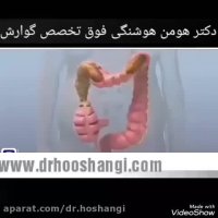 عوارض یبوست