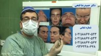 فیلم واقعی عمل ترمیمی بینی با استفاده از غضروف دنده توسط دکتر حمید رضا فتحی