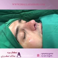 فیلم جراحی بینی طبیعی مردانه توسط دکتر سوره علاف اکبری
