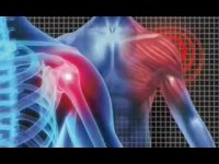 درد شانه چطور بوجود می آید