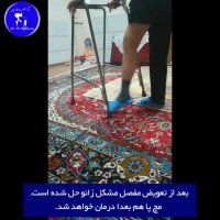 بیمار مبتلا به فلج اطفال