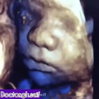 سونوگرافی دوران بارداری