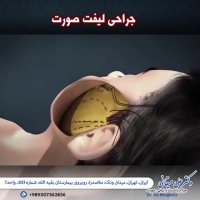 انیمیشن جراحی لیفت صورت