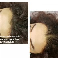 اسکالپ بسیار طبیعی قسمت هرلاین