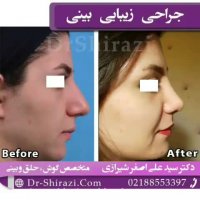 فیلم عمل بینی