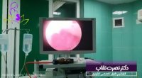 بررسی حفره رحم با دوربین | جراحی هیستروسکوپی