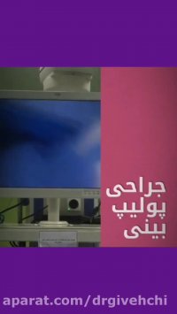 مراحل جراحی زیبایی بینی