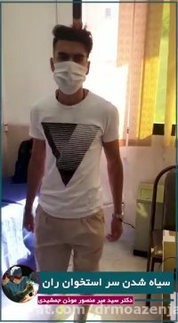 فیلم درمان سیاه شدن سر استخوان