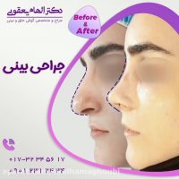 فیلم عمل زیبایی بینی