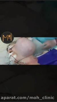 فیلم توده ی بسیار  بزرگ صورت!