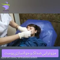 مزوتراپی ضد لک و جوانسازی پوست