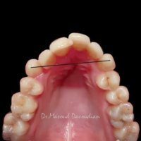 ارتودنسی غرب تهران | دکتر داوودیان