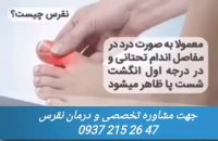 علائم نقرس چیست ؟؟ بهترین روش درمانی چه می‌باشد ؟؟؟