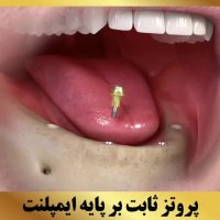 بهترین کلینیک | کلینیک دندانپزشکی سیمادنت