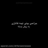 نتیجه جراحی نیمه فانتزی بینی بعد از 3 سال