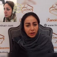 فیلم کاشت ابرو -کلینیک تخصصی رنسانس