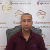 کاشت مو رنسانس -کلینیک تخصصی رنسانس