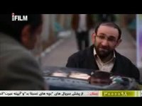 کاشت موی یک هنرپیشه