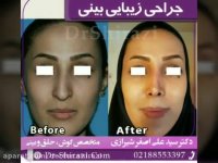 فیلم عمل بینی