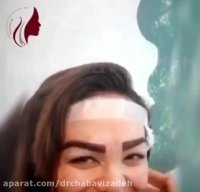 فیلم رضایت مراجعه کننده بلافاصله پس از کاشت ابرو
