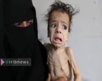 قحطی، ابزار جنگی سعودی‌ها در یمن