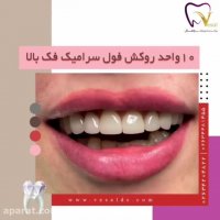 روکش سرامیکی دندان های فک بالا
