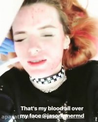 میکروندلینگ