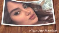 7 سال بعد از جراحی بینی	توسط دکتر شهریار یحیوی