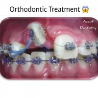 ارتودنسی دندان -دکترمجیدقیاسی دندانپزشک زیبایی مشهد