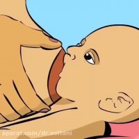 فشار دادن نوک سینه در حالت خواب آلودگی نوزاد