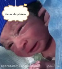 سونوگرافی جنین