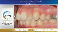 ارتودونسی شرق تهران | دکتر داوودیان