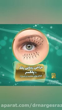 جراحی زیبایی پلک یا پلکسر کدام‌ روش مناسب تر است