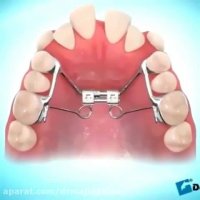 ارتودنسی دندان-دکترمجیدقیاسی دندانپزشک زیبایی مشهد